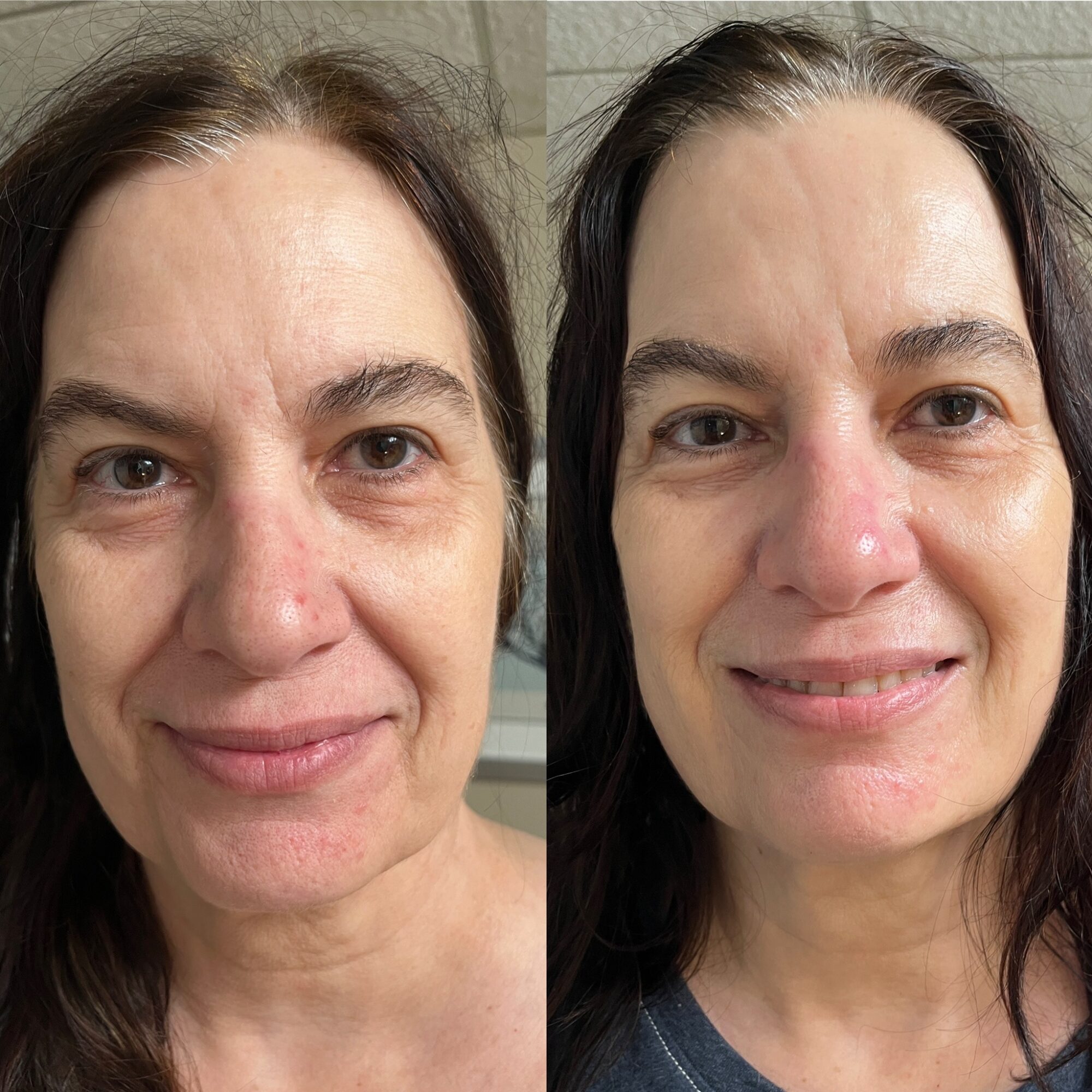 Side-by-side images of a woman with different facial expressions, showing skin and hair details, smiling in the second image.
